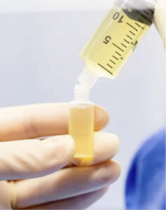 Imagen de suero autólogo